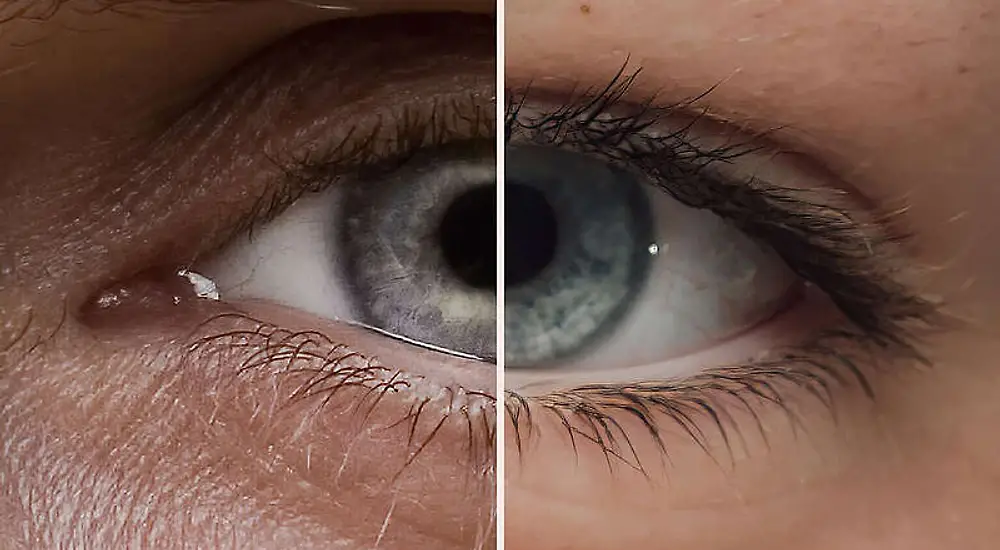 Silmästä silmään